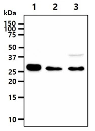 WB analysis of various samples using GTX57655 IMPA1 antibody. Lane 1 : Jurkat whole cell lysate Lane 2 : Raji whole cell lysate Lane 3 : NIH-3T3 whole cell lysate Loading : 40 microg Dilution : 1:1000