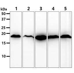 WB analysis of various samples using GTX57658 SOD1 antibody. Lane 1 : A549 whole cell lysate Lane 2 : A431 whole cell lysate Lane 3 : 293T whole cell lysate Lane 4 : PC-3 whole cell lysate Lane 5 : U87-MG whole cell lysate Loading : 40 microg Dilution : 1:1000
