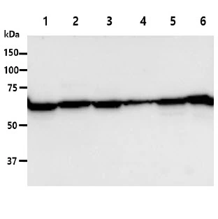 WB analysis of various samples using GTX57659 PGM1 antibody. Lane 1 : 293T whole cell lysate Lane 2 : HepG2 whole cell lysate Lane 3 : NIH-3T3 whole cell lysate Lane 4 : Jurkat whole cell lysate Lane 5 : HeLa whole cell lysate Lane 6 : U87-MG whole cell lysate Loading : 40 microg Dilution : 1:1000