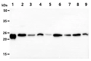 WB analysis of various samples using GTX57660 PRX III antibody. Lane 1 : Recombinant Human PRX III protein (50 ng) Lane 2 : HeLa whole cell lysate (40 microg) Lane 3 : HepG2 whole cell lysate (40 microg) Lane 4 : TF1 whole cell lysate (40 microg) Lane 5 : U87-MG whole cell lysate (40 microg) Lane 6 : Raji whole cell lysate (40 microg) Lane 7 : 293T whole cell lysate (40 microg) Lane 8 : Jurkat whole cell lysate (40 microg) Lane 9 : MCF-7 whole cell lysate (40 microg)