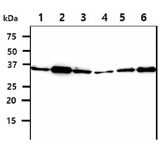 WB analysis of various samples using GTX57661 SGTA antibody. Lane 1 : HeLa whole cell lysate Lane 2 : K562 whole cell lysate Lane 3 : A549 whole cell lysate Lane 4 : MCF-7 whole cell lysate Lane 5 : LNCap whole cell lysate Lane 6 : 293T whole cell lysate Loading : 40 microg Dilution : 1:1000