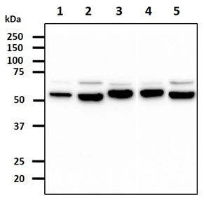 WB analysis of various samples using GTX57663 ERp57 antibody. Lane 1 : HeLa whole cell lysate Lane 2 : HepG2 whole cell lysate Lane 3 : NIH-3T3 whole cell lysate Lane 4 : Raw 264.7 whole cell lysate Lane 5 : LNCap whole cell lysate Loading : 40 microg Dilution : 1:1000