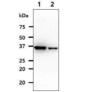 WB analysis of various samples using GTX57665 QPRT antibody. Lane 1 : HepG2 whole cell lysate Lane 2 : K562 whole cell lysate Loading : 40 microg Dilution : 1:1000