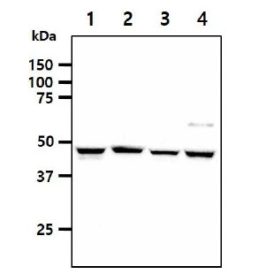 WB analysis of various samples using GTX57666 SHMT1 antibody. Lane 1 : A549 whole cell lysate Lane 2 : HeLa whole cell lysate Lane 3 : NIH-3T3 whole cell lysate Lane 4 : LNCap whole cell lysate Loading : 40 microg Dilution : 1:1000