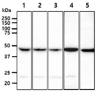 WB analysis of various samples using GTX57669 PGD antibody. Lane 1 : HeLa whole cell lysate Lane 2 : MCF-7 whole cell lysate Lane 3 : 293T whole cell lysate Lane 4 : A549 whole cell lysate Lane 5 : Jurkat whole cell lysate Loading : 40 microg Dilution : 1:1000 WB analysis of various samples using GTX57669 PGD antibody. Lane 1 : HeLa whole cell lysate Lane 2 : MCF-7 whole cell lysate Lane 3 : 293T whole cell lysate Lane 4 : A549 whole cell lysate Lane 5 : Jurkat whole cell lysate Loading : 40 microg Dilution : 1:1000