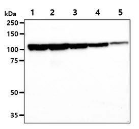 WB analysis of various samples using GTX57670 JAK2 antibody. Lane 1 : K562 whole cell lysate Lane 2 : TF-1 whole cell lysate Lane 3 : 293T whole cell lysate Lane 4 : Jurkat whole cell lysate Lane 5 : THP-1 whole cell lysate Loading : 40 microg Dilution : 1:1000