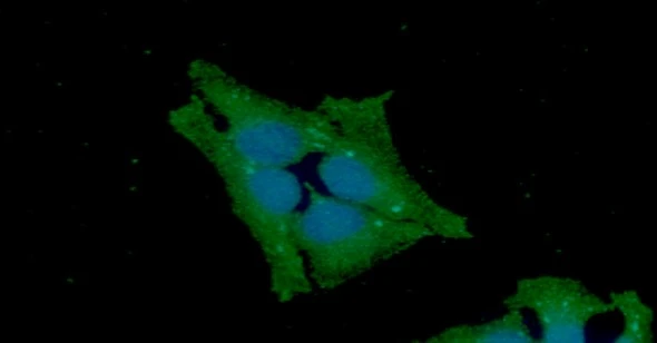 ICC/IF analysis of HeLa cells using GTX57671 GSS antibody. Blue: DAPI Green: Primary antibody Dilution: 1:100 ICC/IF analysis of HeLa cells using GTX57671 GSS antibody. Blue: DAPI Green: Primary antibody Dilution: 1:100