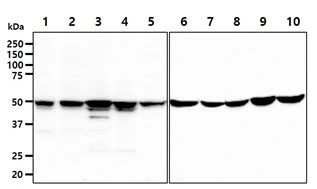 WB analysis of various samples using GTX57671 GSS antibody. Lane 1 : MDA-MB231 whole cell lysate Lane 2 : WiDr whole cell lysate Lane 3 : SW480 whole cell lysate Lane 4 : A427 whole cell lysate Lane 5 : MCF-7 whole cell lysate Lane 6 : 293T whole cell lysate Lane 7 : HeLa whole cell lysate Lane 8 : HT1080 whole cell lysate Lane 9 : U87-MG whole cell lysate Lane 10 : A549 whole cell lysate Loading : 40 microg Dilution : 1:1000