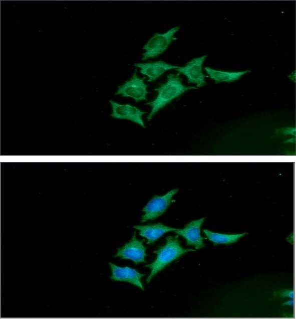 ICC/IF analysis of HeLa cells using GTX57673 ENO1 + ENO2 antibody [AT1G7]. Blue: DAPI Green: Primary antibody Dilution: 1:100