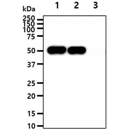 WB analysis of various samples using GTX57673 ENO1 + ENO2 antibody [AT1G7]. Lane 1 : Recombinant Human ENO1 (Alpha-enolase) protein Lane 2 : Recombinant Human ENO2 (Gamma-enolase) protein Lane 3 : Recombinant Human ENO3 (Beta-enolase) protein Loading : 50 ng Dilution : 1:1000
