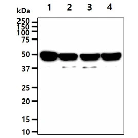 WB analysis of various samples using GTX57673 ENO1 + ENO2 antibody [AT1G7]. Lane 1 : PC-3 whole cell lysate Lane 2 : MCF-7 whole cell lysate Lane 3 : 293T whole cell lysate Lane 4 : HeLa whole cell lysate Loading : 40 microg Dilution : 1:1000