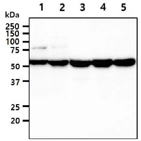 WB analysis of various samples using GTX57674 UGDH antibody. Lane 1 : HeLa whole cell lysate Lane 2 : NIH-3T3 whole cell lysate Lane 3 : HepG2 whole cell lysate Lane 4 : A549 whole cell lysate Lane 5 : MCF-7 whole cell lysate Loading : 40 microg Dilution : 1:1000 WB analysis of various samples using GTX57674 UGDH antibody. Lane 1 : HeLa whole cell lysate Lane 2 : NIH-3T3 whole cell lysate Lane 3 : HepG2 whole cell lysate Lane 4 : A549 whole cell lysate Lane 5 : MCF-7 whole cell lysate Loading : 40 microg Dilution : 1:1000