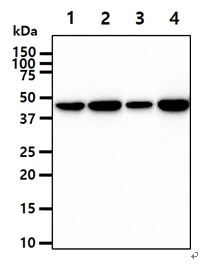 WB analysis of various samples using GTX57675 Creatine kinase (brain) antibody. Lane 1 : HeLa whole cell lysate Lane 2 : 293T whole cell lysate Lane 2 : K562 whole cell lysate Lane 2 : LNCap whole cell lysate Loading : 40 microg Dilution : 1:1000