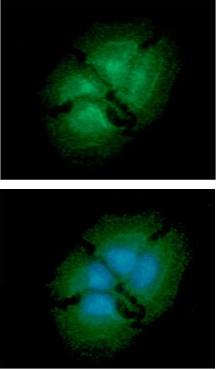 ICC/IF analysis of A549 cells using GTX57679 EBP1 antibody. Blue: DAPI Green: Primary antibody Dilution: 1:100