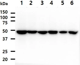 WB analysis of various samples using GTX57679 EBP1 antibody. Lane 1 : HeLa whole cell lysate Lane 2 : MCF-7 whole cell lysate Lane 3 : A549 whole cell lysate Lane 4 : 293T whole cell lysate Lane 5 : A431 whole cell lysate Lane 6 : Jurkat whole cell lysate Loading : 40 microg Dilution : 1:1000