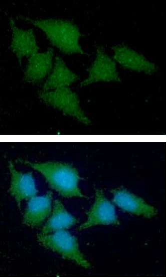 ICC/IF analysis of HeLa cells using GTX57681 Cystatin A antibody. Blue: DAPI Green: Primary antibody Dilution: 1:100 ICC/IF analysis of HeLa cells using GTX57681 Cystatin A antibody. Blue: DAPI Green: Primary antibody Dilution: 1:100
