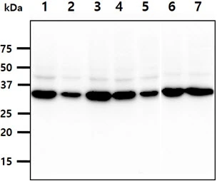 WB analysis of various samples using GTX57682 PPA1 antibody. Lane 1 : HeLa whole cell lysate Lane 2 : A431 whole cell lysate Lane 3 : 293T whole cell lysate Lane 4 : HepG2 whole cell lysate Lane 5 : U87-MG whole cell lysate Lane 6 : PC-3 whole cell lysate Lane 7 : WiDr whole cell lysate Loading : 40 microg Dilution : 1:1000