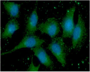 ICC/IF analysis of A549 cells using GTX57683 S100A11 antibody. Blue: DAPI Green: Primary antibody Dilution: 1:100