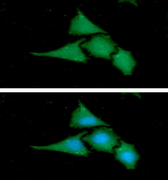 ICC/IF analysis of HeLa cells using GTX57685 BAG2 antibody. Blue: DAPI Green: Primary antibody Dilution: 1:100 ICC/IF analysis of HeLa cells using GTX57685 BAG2 antibody. Blue: DAPI Green: Primary antibody Dilution: 1:100