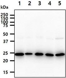 WB analysis of various samples using GTX57685 BAG2 antibody. Lane 1 : Jurkat whole cell lysate Lane 2 : A549 whole cell lysate Lane 3 : K562 whole cell lysate Lane 4 : HepG2 whole cell lysate Lane 5 : HeLa whole cell lysate Loading : 40 microg Dilution : 1:1000