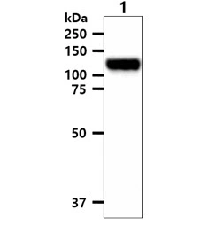 WB analysis of PC-3 whole cell lysate using GTX57687 EphA2 antibody. Loading : 40 microg Dilution : 1:1000 WB analysis of PC-3 whole cell lysate using GTX57687 EphA2 antibody. Loading : 40 microg Dilution : 1:1000