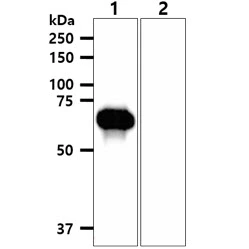 WB analysis of various samples using GTX57687 EphA2 antibody. Lane 1 : Recombinant Human EPHA2 extracellular domain Lane 2 : Recombinant Human EPHA2 cytoplasmic domain Loading : 20 ng Dilution : 1:1000