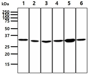 WB analysis of various samples using GTX57689 PPCS antibody. Lane 1 : Jurkat whole cell lysate Lane 2 : HepG2 whole cell lysate Lane 3 : HeLa whole cell lysate Lane 4 : A549 whole cell lysate Lane 5 : MCF-7 whole cell lysate Lane 6 : SK-OV-3 whole cell lysate Loading : 40 microg Dilution : 1:1000 WB analysis of various samples using GTX57689 PPCS antibody. Lane 1 : Jurkat whole cell lysate Lane 2 : HepG2 whole cell lysate Lane 3 : HeLa whole cell lysate Lane 4 : A549 whole cell lysate Lane 5 : MCF-7 whole cell lysate Lane 6 : SK-OV-3 whole cell lysate Loading : 40 microg Dilution : 1:1000