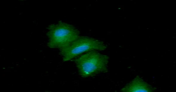 ICC/IF analysis of A549 cells using GTX57690 TIP30 antibody. Blue: DAPI Green: Primary antibody Dilution: 1:100 ICC/IF analysis of A549 cells using GTX57690 TIP30 antibody. Blue: DAPI Green: Primary antibody Dilution: 1:100