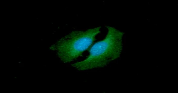 ICC/IF analysis of HeLa cells using GTX57690 TIP30 antibody. Blue: DAPI Green: Primary antibody Dilution: 1:100