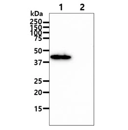 WB analysis of various samples using GTX57691 GOT1 antibody. Lane 1 : Recombinant Human GOT1 protein Lane 2 : Recombinant Human GOT2 protein Loading : 100 ng Dilution : 1:1000