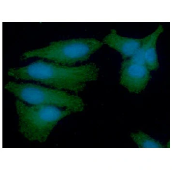 ICC/IF analysis of HeLa cells using GTX57692 PSMD11 antibody. Blue: DAPI Green: Primary antibody Dilution: 1:100 ICC/IF analysis of HeLa cells using GTX57692 PSMD11 antibody. Blue: DAPI Green: Primary antibody Dilution: 1:100
