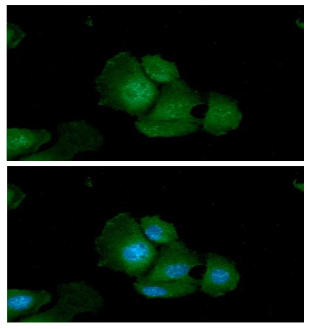 ICC/IF analysis of Hep3B cells using GTX57693 Adenylate kinase 1 antibody. Blue: DAPI Green: Primary antibody Dilution: 1:100