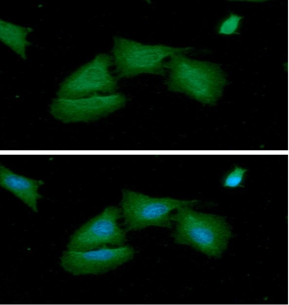 ICC/IF analysis of A549 cells using GTX57693 Adenylate kinase 1 antibody. Blue: DAPI Green: Primary antibody Dilution: 1:100