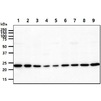 WB analysis of various samples using GTX57693 Adenylate kinase 1 antibody. Lane 1 : HeLa whole cell lysate Lane 2 : U87-MG whole cell lysate Lane 3 : K562 whole cell lysate Lane 4 : 293T whole cell lysate Lane 5 : HepG2 whole cell lysate Lane 6 : A549 whole cell lysate Lane 7 : MCF-7 whole cell lysate Lane 8 : SK-OV-3 whole cell lysate Lane 9 : PC-3 whole cell lysate Loading : 40 microg Dilution : 1:1000
