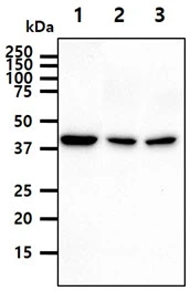 WB analysis of various samples using GTX57695 PPME1 antibody. Lane 1 : HeLa whole cell lysate Lane 2 : K562 whole cell lysate Lane 3 : A549 whole cell lysate Loading : 40 microg Dilution : 1:1000 WB analysis of various samples using GTX57695 PPME1 antibody. Lane 1 : HeLa whole cell lysate Lane 2 : K562 whole cell lysate Lane 3 : A549 whole cell lysate Loading : 40 microg Dilution : 1:1000