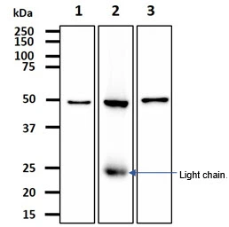 WB analysis of various samples using GTX57696 ALDH2 antibody. Lane 1 : HepG2 whole cell lysate Lane 2 : Mouse liver tissue lysate Lane 3 : Mouse lung tissue lysate Dilution : 1:1000