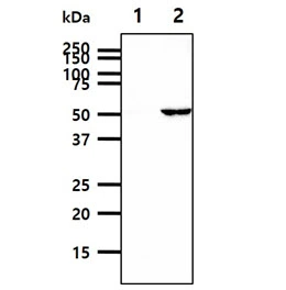 WB analysis of various samples using GTX57696 ALDH2 antibody. Lane 1 : 293T cell lysate Lane 2 : ALDH2 transfected 293T cell lysate Loading : 40 microg Dilution : 1:500