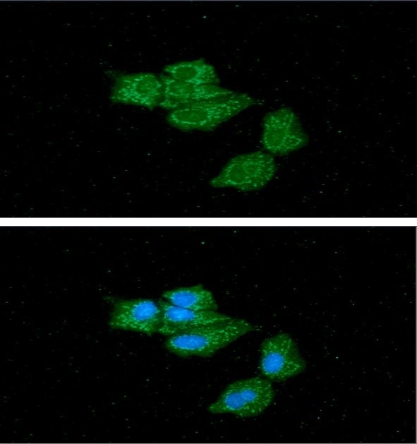 ICC/IF analysis of Hep3B cells using GTX57702 ACADS antibody. Blue: DAPI Green: Primary antibody Dilution: 1:100 ICC/IF analysis of Hep3B cells using GTX57702 ACADS antibody. Blue: DAPI Green: Primary antibody Dilution: 1:100