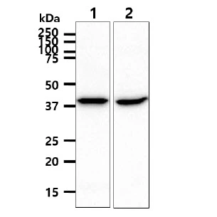WB analysis of various samples using GTX57702 ACADS antibody. Lane 1 : HepG2 whole cell lysate Lane 2 : LNCap whole cell lysate Loading : 40 microg Dilution : 1:1000