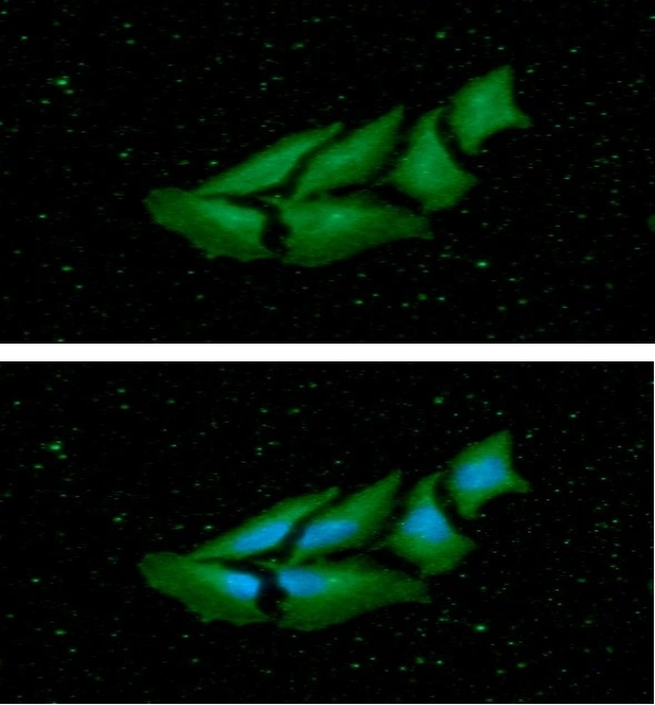 ICC/IF analysis of HeLa cells using GTX57703 nm23-H1 antibody. Blue: DAPI Green: Primary antibody Dilution: 1:100 ICC/IF analysis of HeLa cells using GTX57703 nm23-H1 antibody. Blue: DAPI Green: Primary antibody Dilution: 1:100