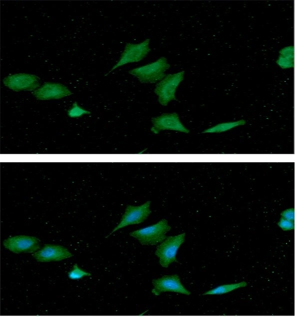 ICC/IF analysis of A549 cells using GTX57703 nm23-H1 antibody. Blue: DAPI Green: Primary antibody Dilution: 1:100