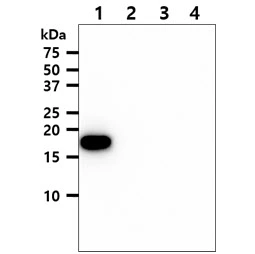 WB analysis of various samples using GTX57703 nm23-H1 antibody. Lane 1 : Recombinant Human NME1 protein Lane 2 : Recombinant Human NME2 protein Lane 3 : Recombinant Human NME3 protein Lane 4 : Recombinant Human NME4 protein Loading : 50 ng Dilution : 1:1000