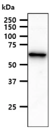 WB analysis of HepG2 whole cell lysate using GTX57705 ACSF2 antibody. Loading : 40 microg Dilution : 1:1000