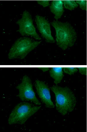 ICC/IF analysis of HeLa cells using GTX57709 RAB7A antibody. Blue: DAPI Green: Primary antibody Dilution: 1:100