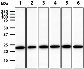 WB analysis of various samples using GTX57709 RAB7A antibody. Lane 1 : HeLa whole cell lysate Lane 2 : Jurkat whole cell lysate Lane 3 : MCF-7 whole cell lysate Lane 4 : PC-3 whole cell lysate Lane 5 : 293T whole cell lysate Lane 6 : SK-OV-3 whole cell lysate Loading : 40 microg Dilution : 1:1000