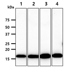 WB analysis of various samples using GTX57712 nm23-H2 antibody. Lane 1 : HeLa whole cell lysate Lane 2 : A549 whole cell lysate Lane 3 : MCF-7 whole cell lysate Lane 4 : LNCap whole cell lysate Loading : 40 microg Dilution : 1:1000