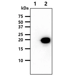 WB analysis of various samples using GTX57712 nm23-H2 antibody. Lane 1 : 293T cell lysate Lane 2 : NME2 transfected 293T cell lysate Loading : 5 microg Dilution : 1:1000