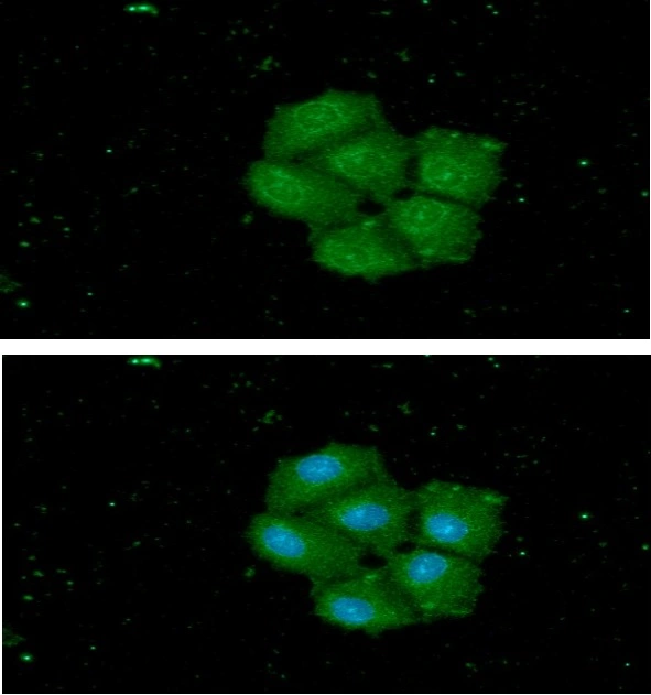 ICC/IF analysis of Hep3B cells using GTX57713 STCH antibody. Blue: DAPI Green: Primary antibody Dilution: 1:100 ICC/IF analysis of Hep3B cells using GTX57713 STCH antibody. Blue: DAPI Green: Primary antibody Dilution: 1:100