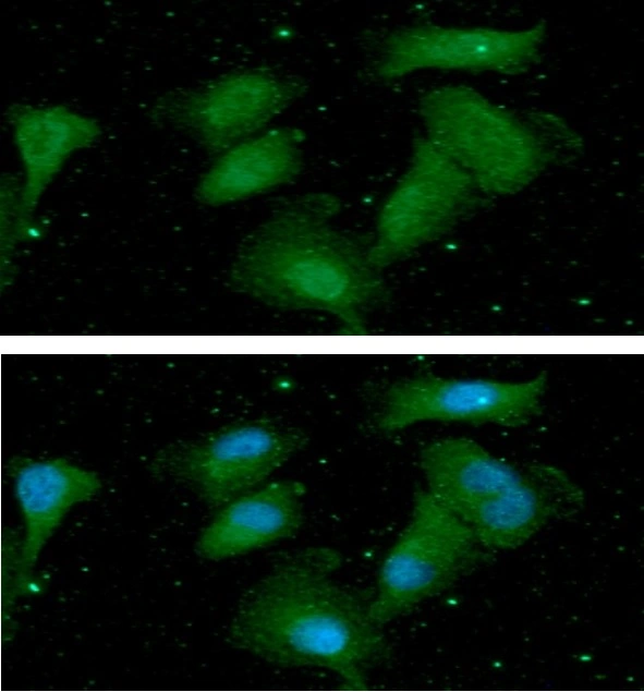 ICC/IF analysis of A549 cells using GTX57714 AKT1 + AKT3 antibody [AT6D5]. Blue: DAPI Green: Primary antibody Dilution: 1:100