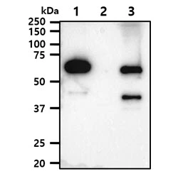 WB analysis of various samples using GTX57714 AKT1 + AKT3 antibody [AT6D5]. Lane 1 : Recombinant Human AKT1 protein Lane 2 : Recombinant Human AKT2 protein Lane 3 : Recombinant Human AKT3 protein Loading : 50 ng Dilution : 1:1000